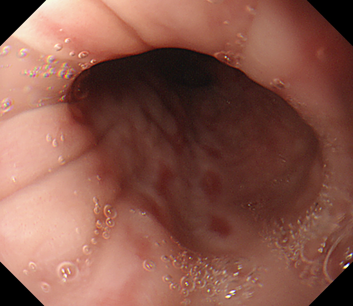 �H������